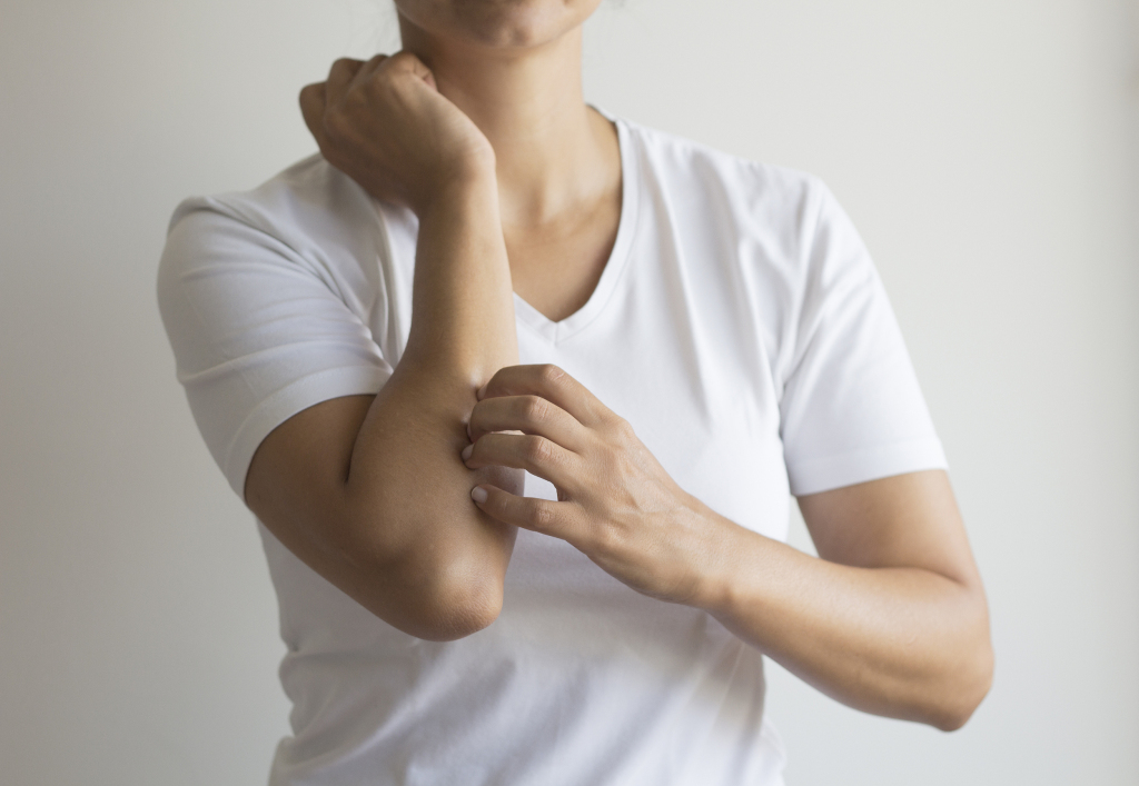 追问｜在公共场合也要挠的湿疹，究竟有多痒？